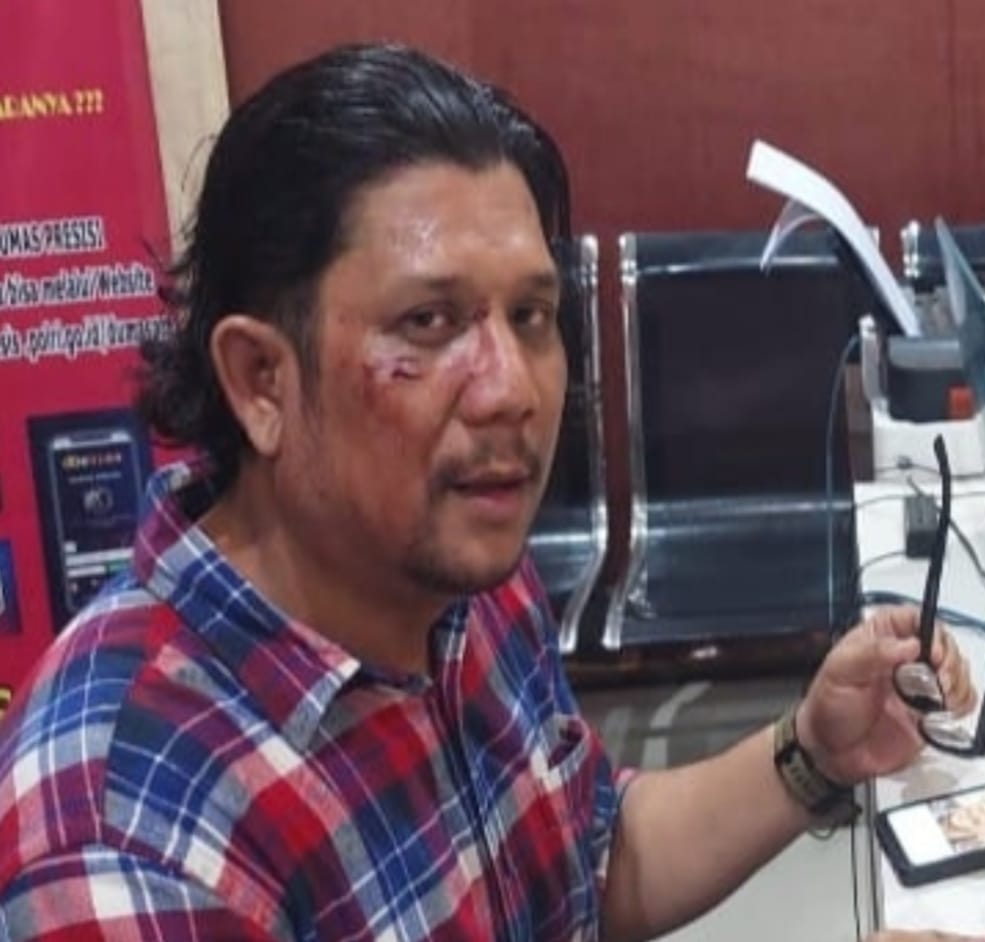 Brutal !!! Wartawan di Sumut dianiaya, Ini Pernyataan Sikap Presidium FPII